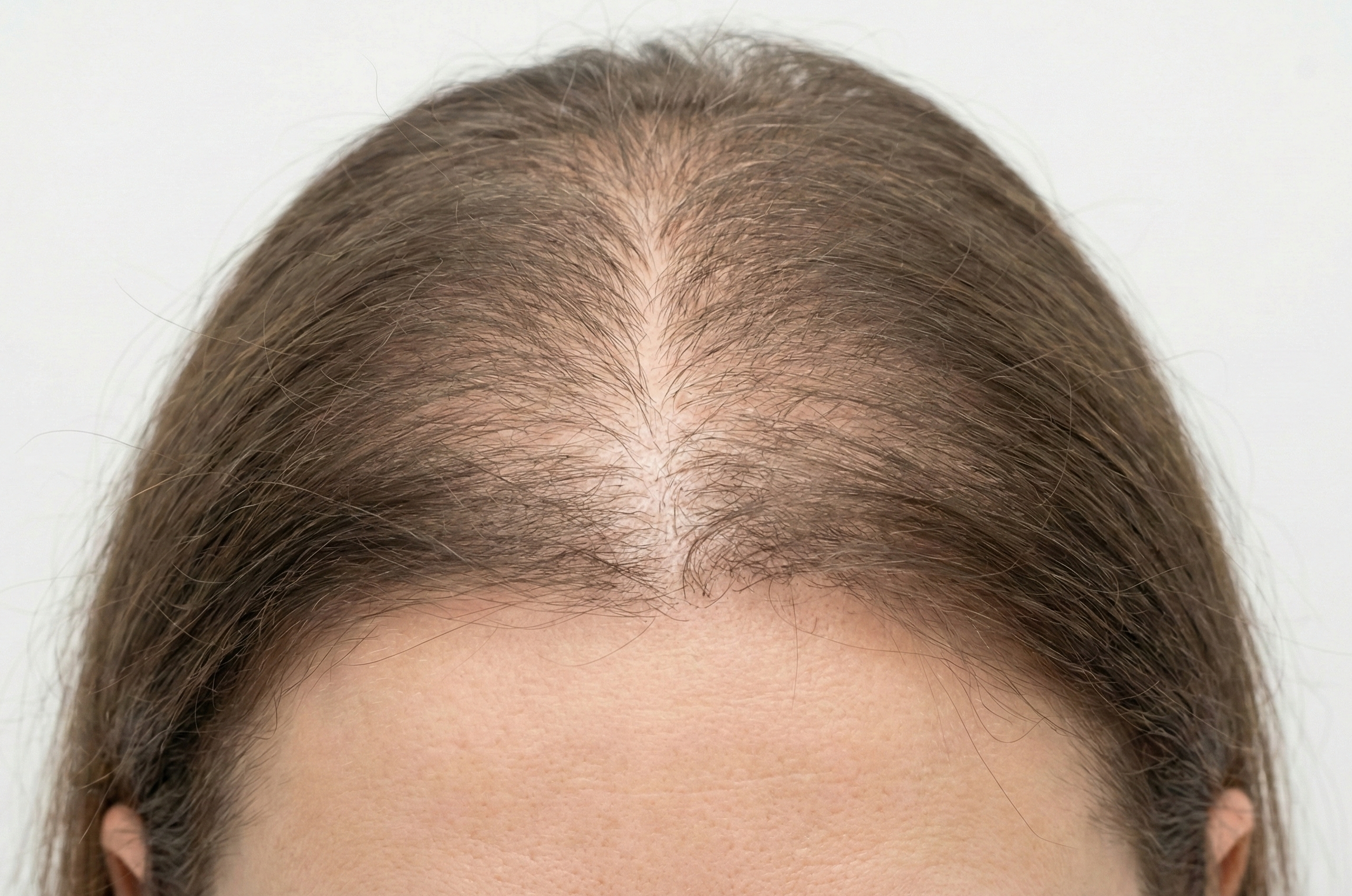 Antes do tratamento capilar